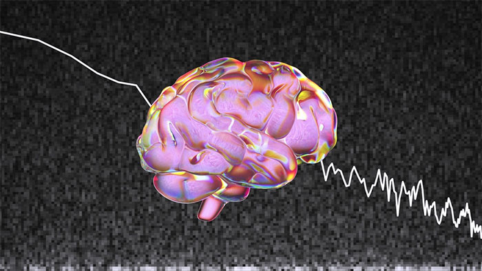 Mô hình AI này có tên là Mind-Vis