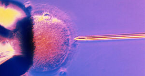 Những điều cần biết về thụ tinh trong ống nghiệm