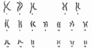 Thuốc lá làm tiêu hủy nhiễm sắc thể Y ở đàn ông