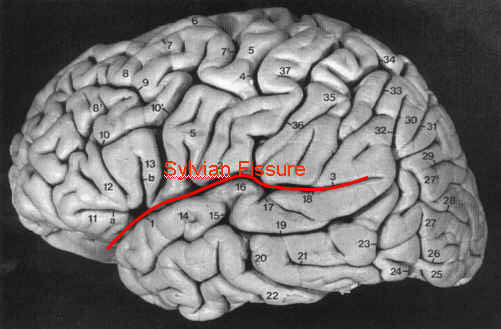 Hình ảnh rãnh Sylvian trên não người Các nhà khoa học đã làm gì với bộ não của Albert Einstein sau khi ông mất?