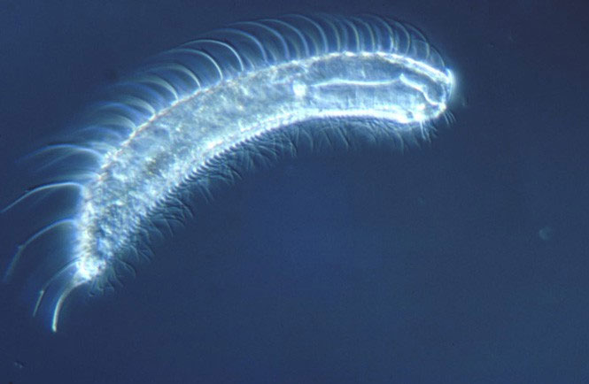 Gastrotricha